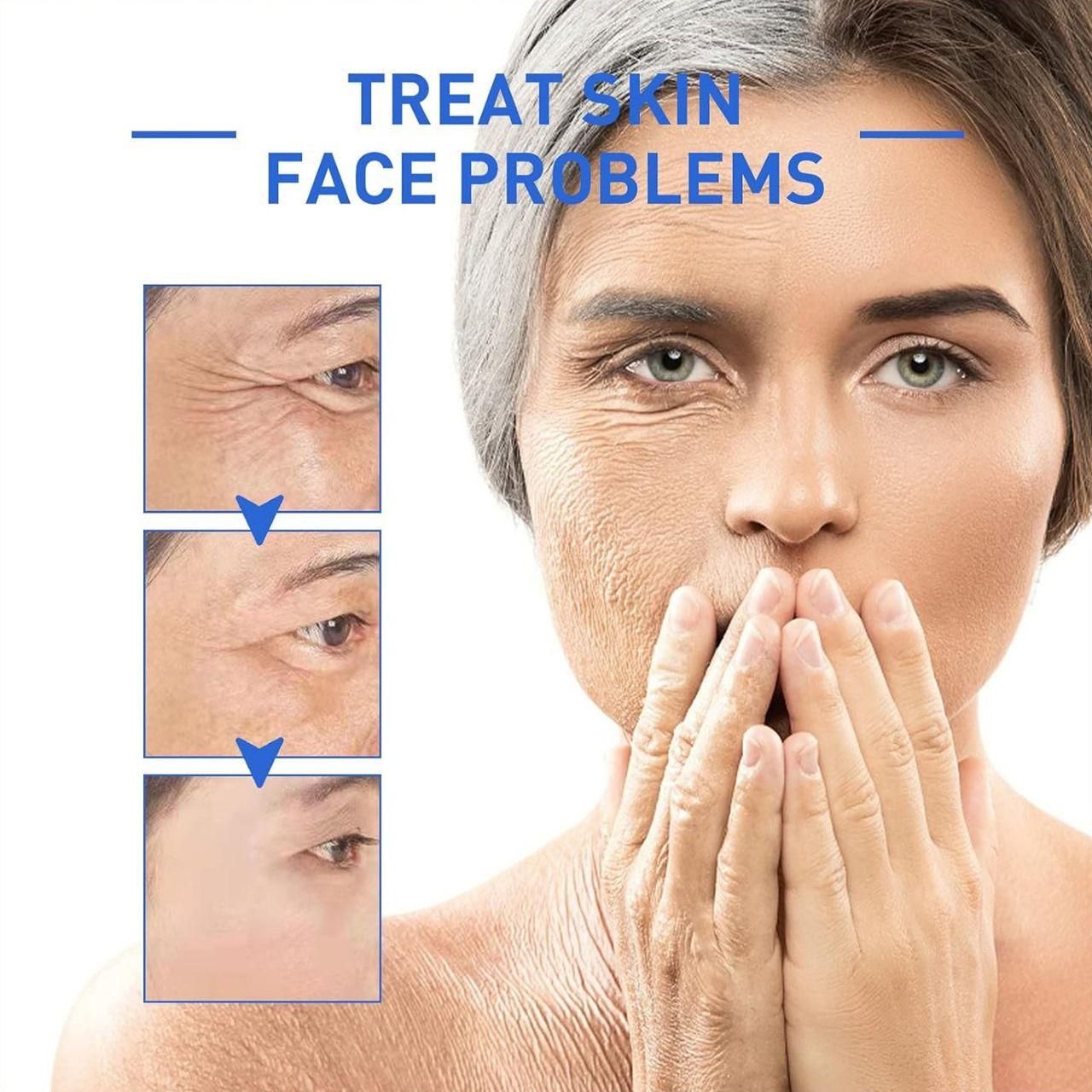 Botox Anti-Aging Serum, Youthfully Botox Face Serum(Pack Of 1)